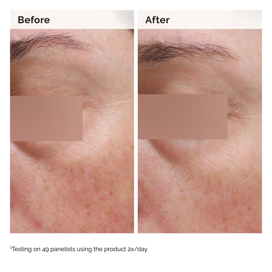 niacinamide-5-face-and-body-emulsion-k0 2024-08-23-ORD-Nia-5pct-Face-Body-B-A-Elasticity-Global-02-1x1.jpg