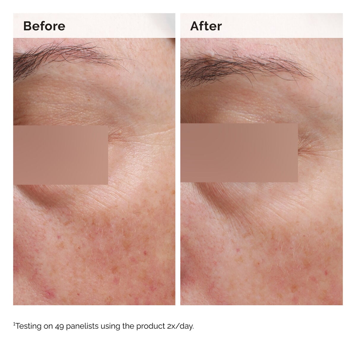 niacinamide-5-face-and-body-emulsion-k0 2024-08-23-ORD-Nia-5pct-Face-Body-B-A-Elasticity-Global-02-1x1.jpg