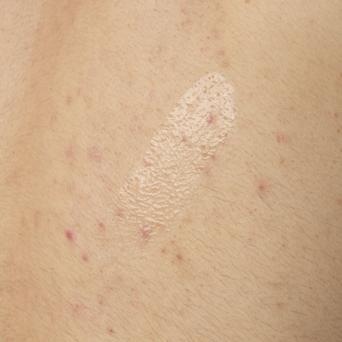salicylic-acid-0-5-body-serum-k2 ORD-salicylic-acid-05-body-240ml-application.jpg