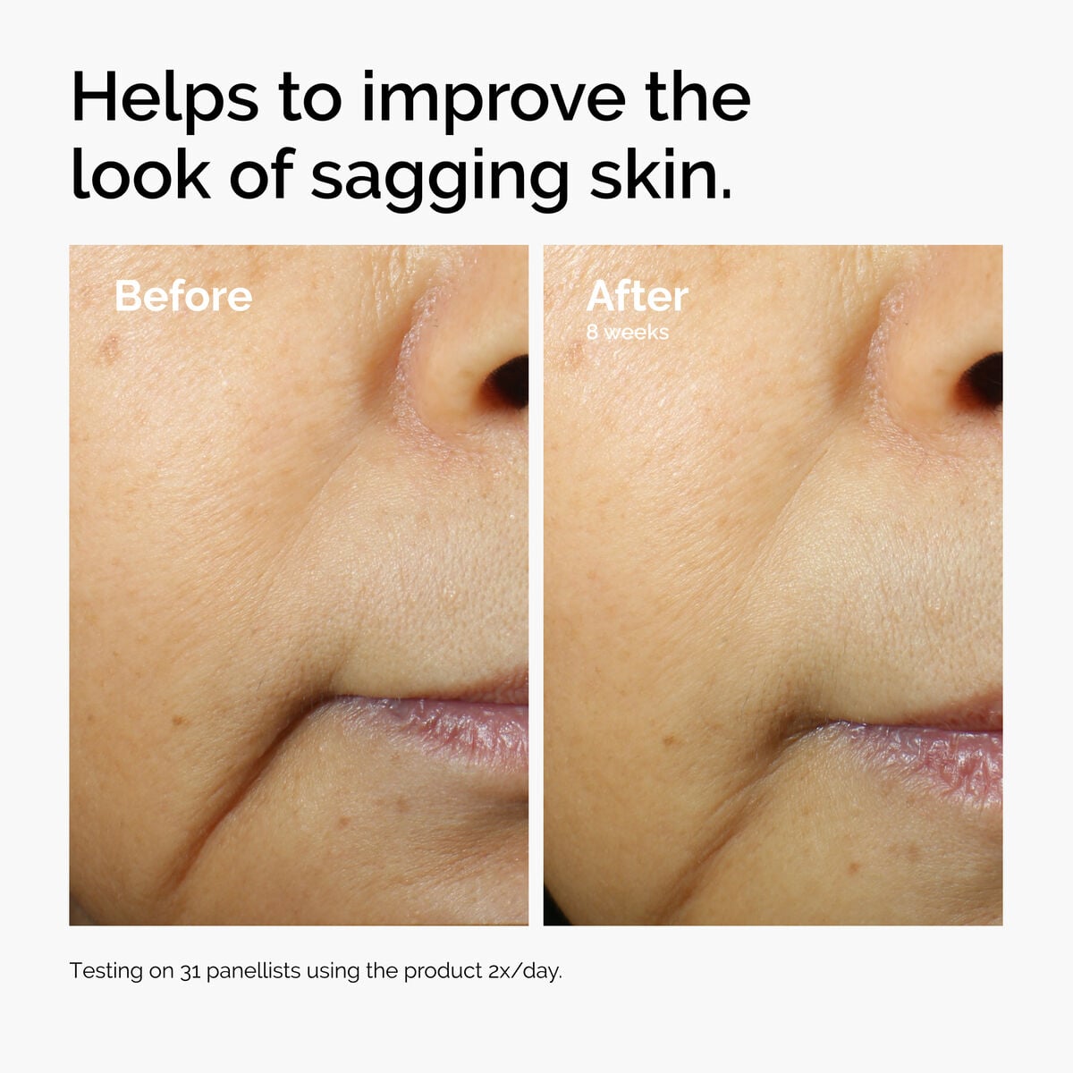 caffeine-3-escin-1-face-serum-o0 ord-caffeine-3pct-escin-1pct-face-serum-before-after-sagging.jpg
