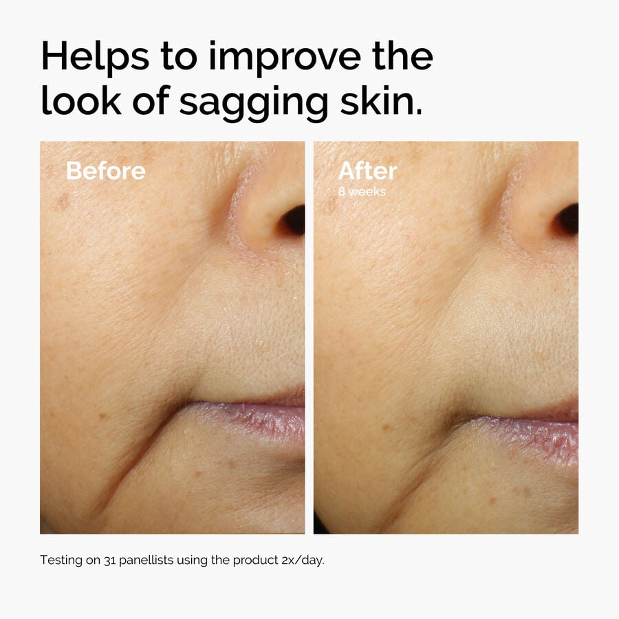 caffeine-3-escin-1-face-serum-l2 ord-caffeine-3pct-escin-1pct-face-serum-before-after-sagging.jpg