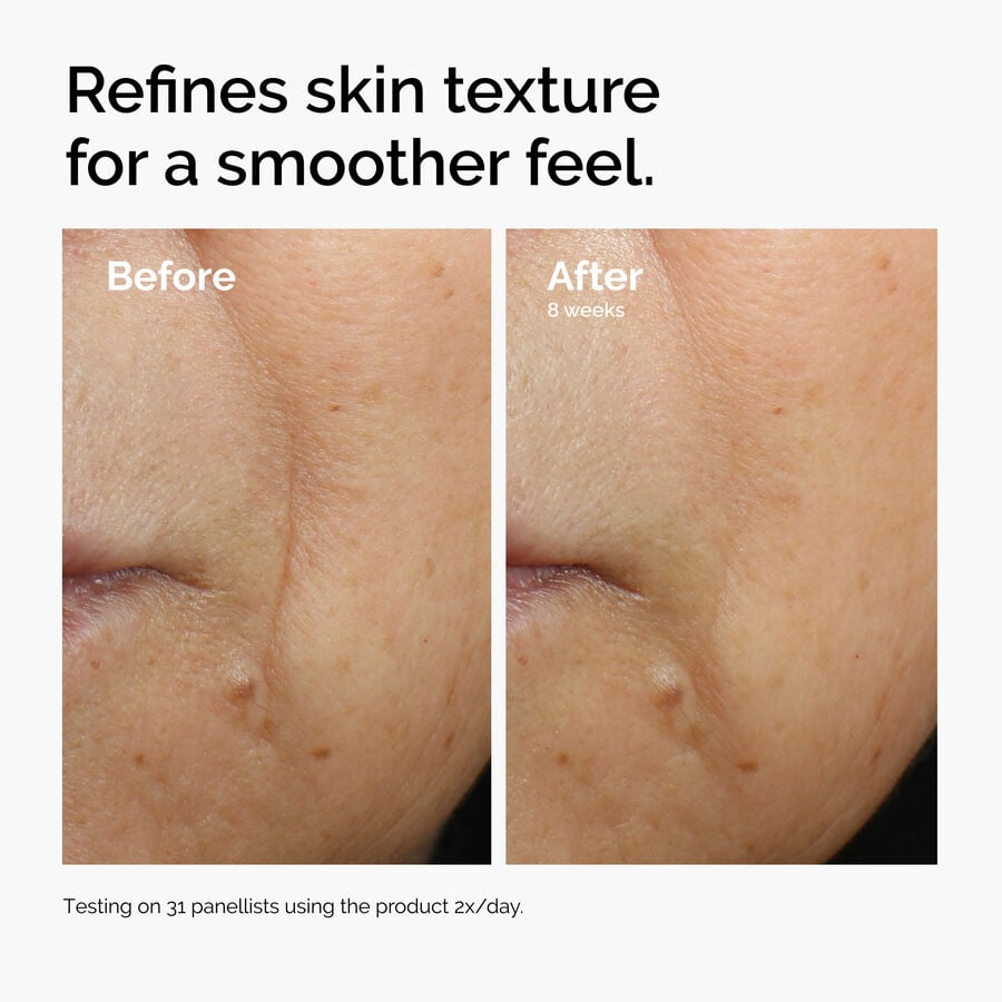 caffeine-3-escin-1-face-serum-o0 ord-caffeine-3pct-escin-1pct-face-serum-before-after-texture.jpg
