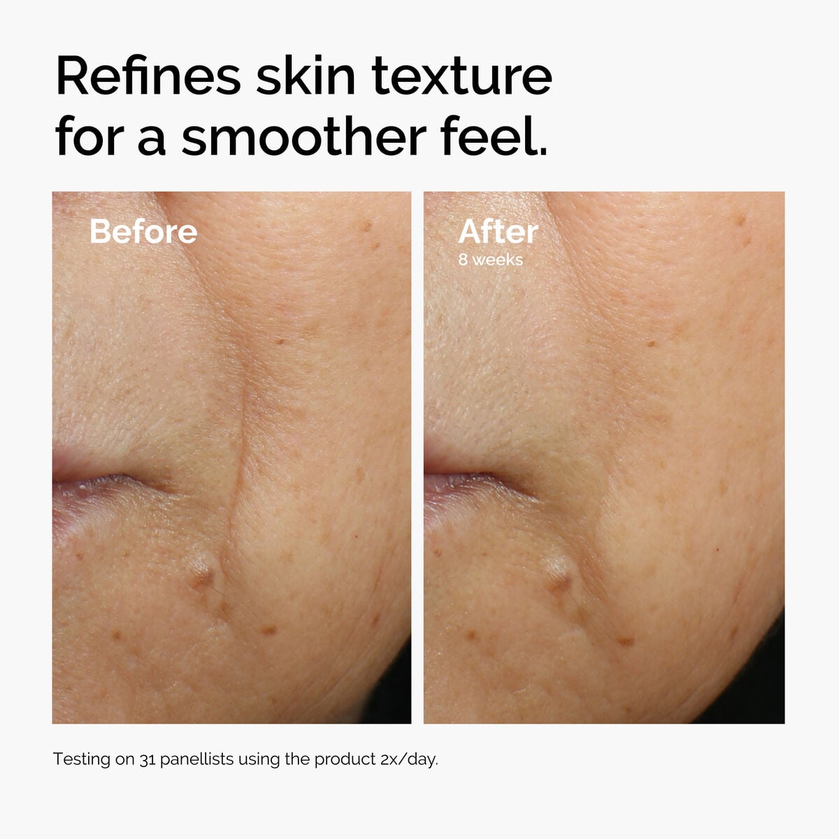 caffeine-3-escin-1-face-serum-l2 ord-caffeine-3pct-escin-1pct-face-serum-before-after-texture.jpg