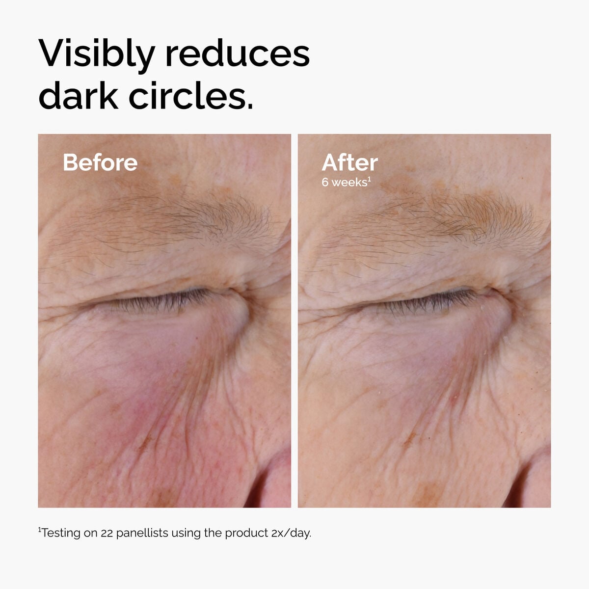 caffeine-solution-5-egcg-eye-serum-z0 ord-caffeine-solution-egcg-dark-circles-before-after.jpg