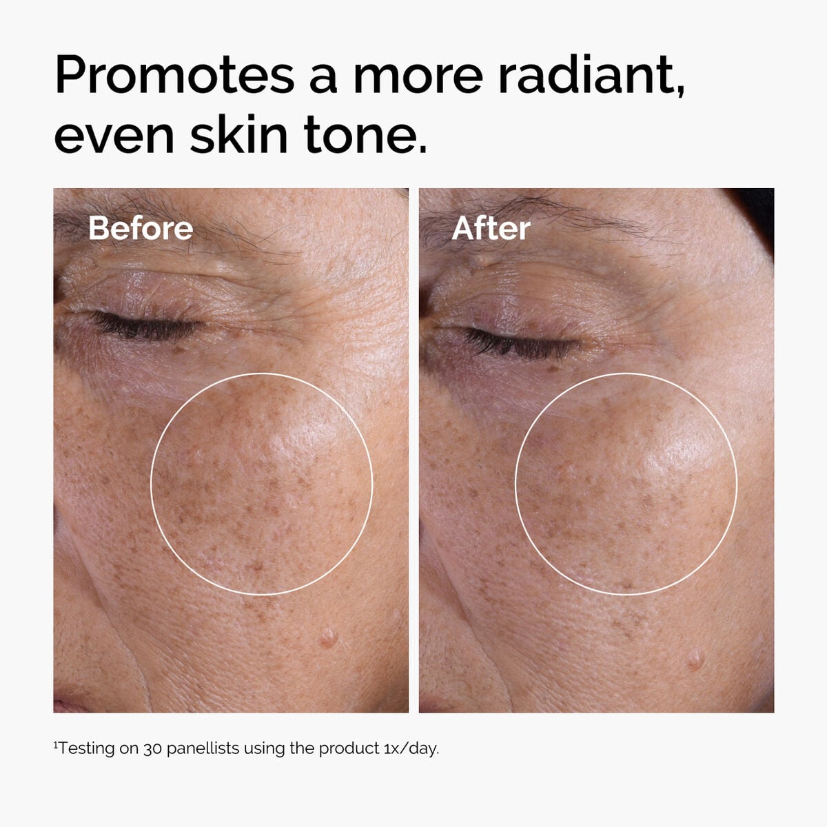 glycolic-acid-7-exfoliating-toner-h6 ord-glycolic-before-after-radiance.jpg
