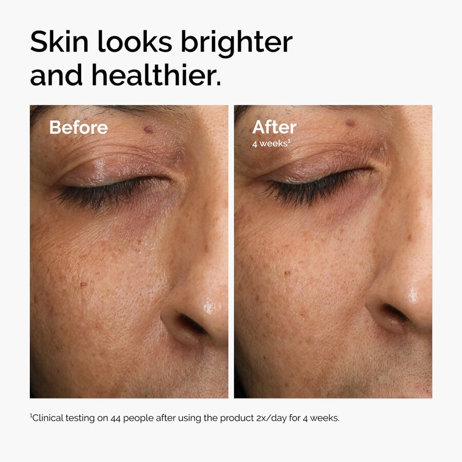 multi-antioxidant-radiance-serum-n8 ord-mars-before-after-healthy.jpg