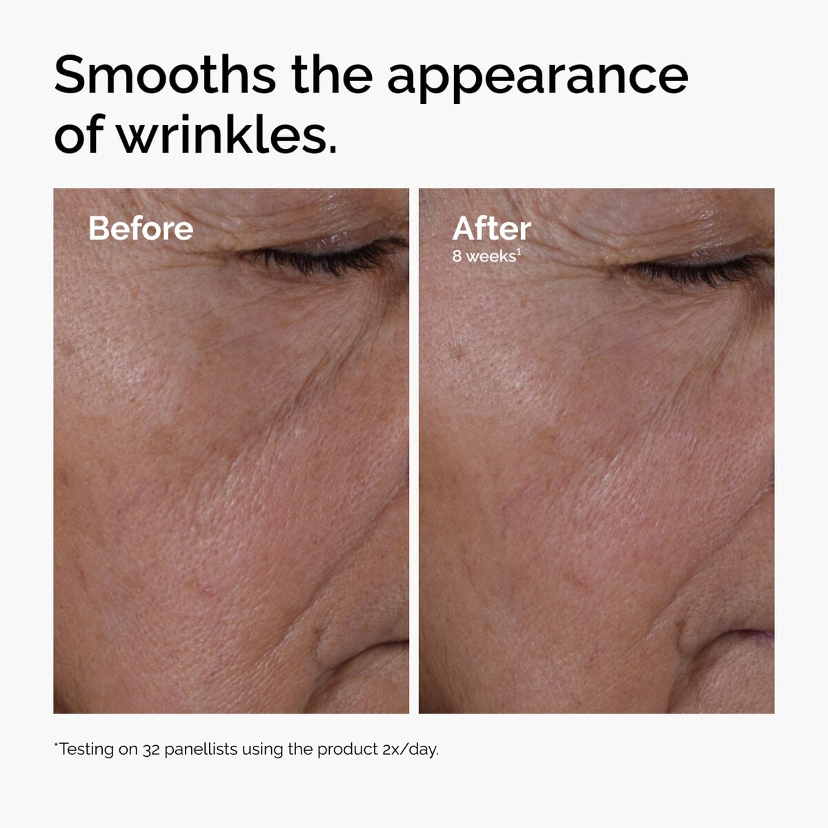multi-peptide-ha-serum-i5 ord-multi-peptide-ha-serum-wrinkles-before-after.jpg