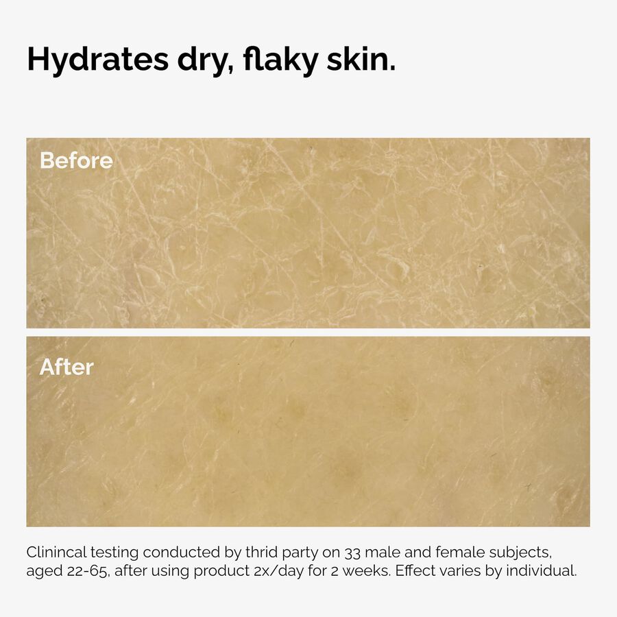 the-body-care-collection-c1 ord-natural-moisturizing-factors-inulin-body-before-after-graphic-02.jpg