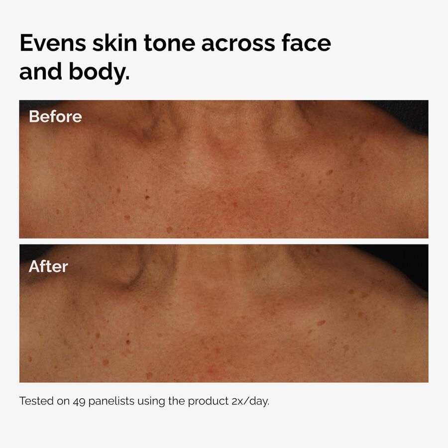 the-body-care-collection-c1 ord-niacinamide-face-body-serum-before-after-even-tone-graphic.jpg