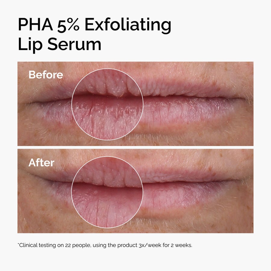 pha-5-exfoliating-lip-serum-o2 ord-pha-5pct-lip-exfoliating-serum-before-after.jpg