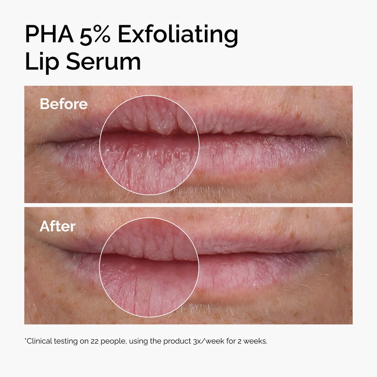 pha-5-exfoliating-lip-serum-o2 ord-pha-5pct-lip-exfoliating-serum-before-after.jpg